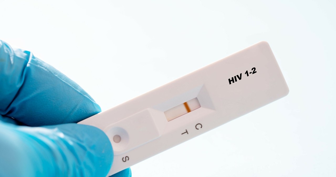 Test w kierunku wirusa HIV można w Polsce wykonać bezpłatnie i anonimowo, w specjalnych Punktach Diagnostyczno-Konsultacyjnych /WLADIMIR BULGAR/Science Photo Library RF/East News /East News