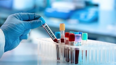 Testy krwi wykażą, który organ starzeje się nam najszybciej