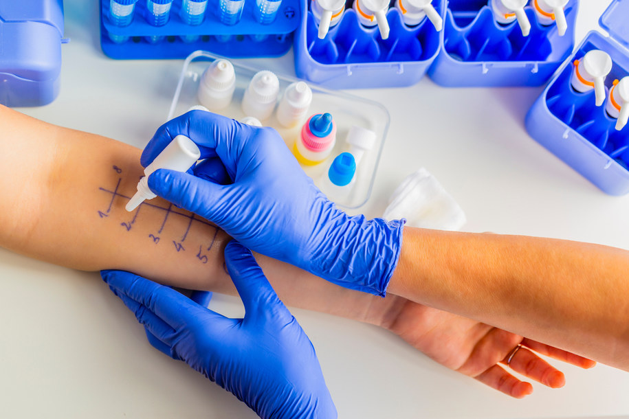 Testy skórne są jedną z metod diagnostyki alergii /Shutterstock