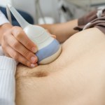 Tętniak w brzuchu. Zagrożenie, którego nie jesteś świadomy