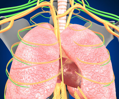 Tętnicze nadciśnienie płucne: Przyczyny, objawy i leczenie