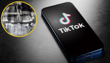 TikToker odkrył u dentysty, że jego kości stały się czarne. Winny jest lek na trądzik