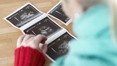 TK oceni, czy aborcja ze względu na wady płodu jest zgodna z konstytucją