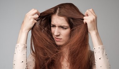 Tłuste włosy przestaną być problemem. W ten sposób odświeżysz je bez mycia i suchego szamponu