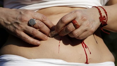 Tnij się aż do krwi. Może Cię zauważą...