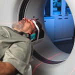 To badanie wykryje najmniejszą zmianę nowotworową. Czym jest PET? 