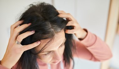 To dlatego tracisz tyle włosów. Dermatolożka zdradza, jak temu zaradzić