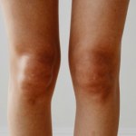 sucha skóra To kojąca wieczorna rutyna, która przywróci zimą miękkość skóry nóg