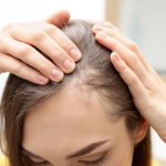 skóra głowy To najgorsza fryzura dla włosów. Przez nią łamią się i wypadają