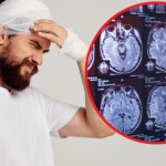 urazy głowy Towarzyszą ci te objawy? To może być wstrząśnienie mózgu