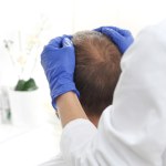 Tradycyjna medycyna chińska w walce z łysieniem androgenowym