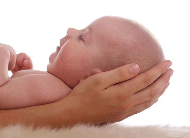 Trądzik niemowlęcy występuje zwykle zaraz po urodzeniu /&copy; Panthermedia