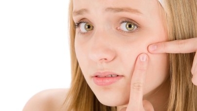 Trądzik przedłuża młodość