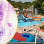 Tragedia na basenie. Ameba "zżerająca mózg" zabiła dziecko 