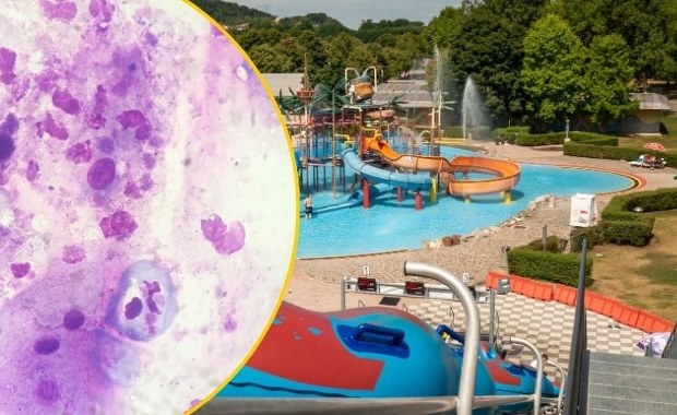 Tragedia na basenie. Ameba "zżerająca mózg" zabiła dziecko 