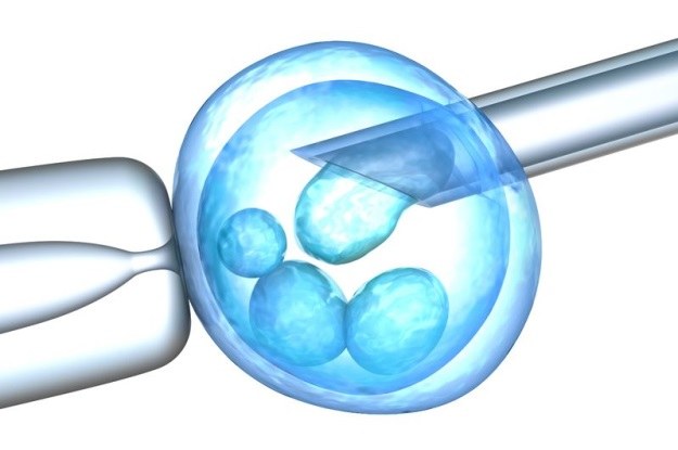 Transfer jąder komórkowych jest standardowo wykorzystywaną metdoą klonowania /123RF/PICSEL