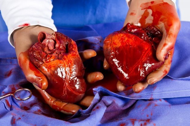 Transplantacja serca to dla wielu pacjentów jedyna szansa na ratunek. Niestety, liczba dawców wciąż jest zbyt mała /123RF/PICSEL