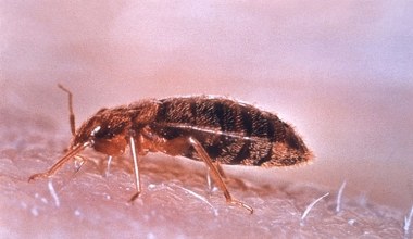 Тримаєте це у спальні? Будьте обережні - клопи це обожнюють