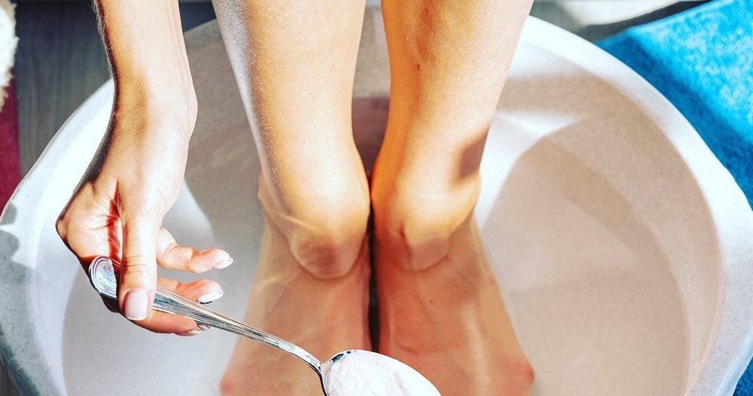 Тріщини на п'ятах більше не будуть проблемою. Домашні засоби, які дійсно працюють /Domena publiczna