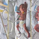 Trojaczki jednojajowe urodziły się w Szczecinie. To rzadki przypadek