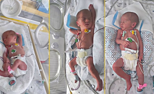 Trojaczki jednojajowe urodziły się w Szczecinie. To rzadki przypadek