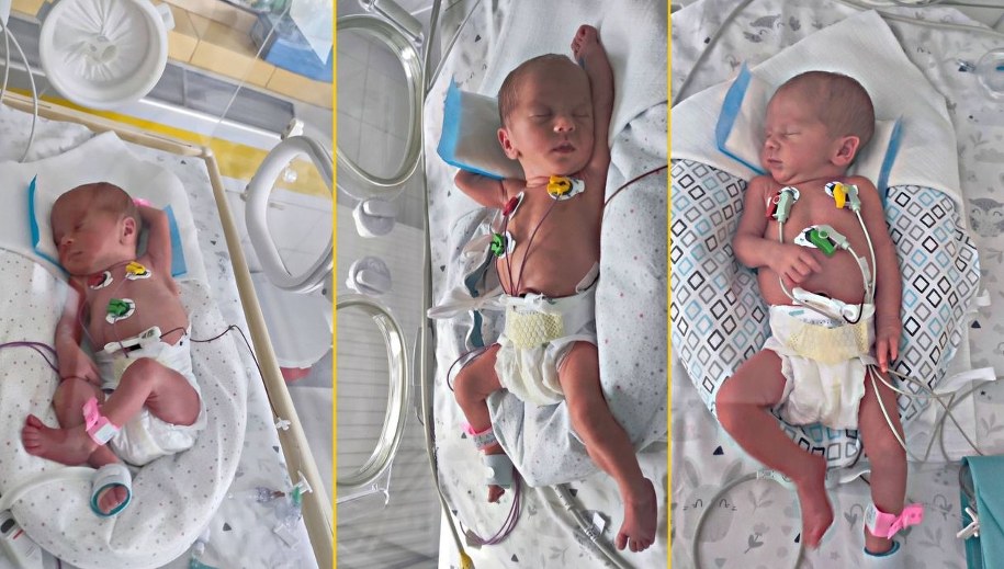 Trojaczki, które urodziły się w Szczecinie /Szpital Szczecin "Zdroje" /