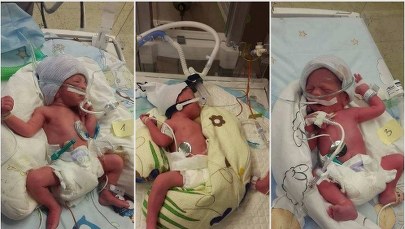 Trojaczki urodziły się w Poznaniu. Gratulujemy rodzicom!