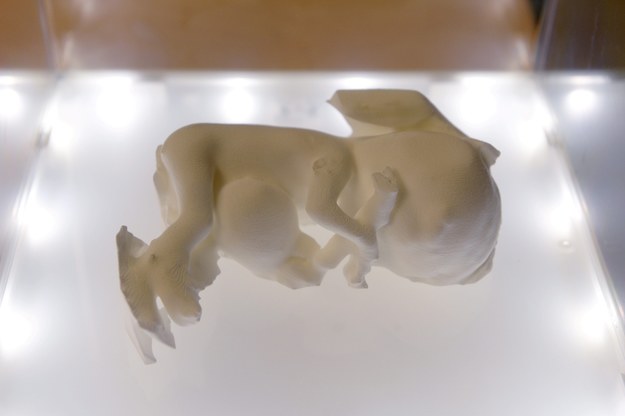 Trójwymiarowy model płodu z wadami rozwojowymi pokazany na konferencji ws. zastosowania druku 3D /Piotr Polak /PAP