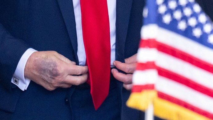 Trump przeszedł badania. Co ze zdrowiem amerykańskiego prezydenta?