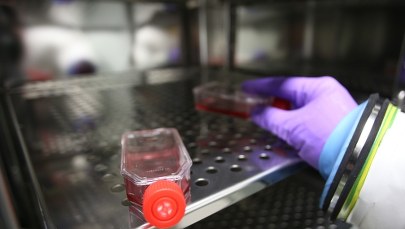 Trzy przypadki gorączki krwotocznej w Mali