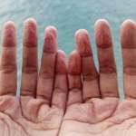 Twoje palce po kąpieli mówią więcej, niż myślisz