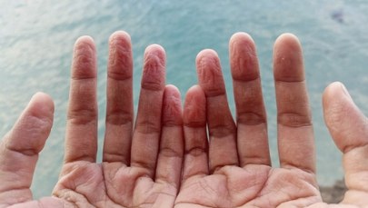 Twoje palce po kąpieli mówią więcej, niż myślisz