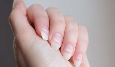 Twoje paznokcie tak wyglądają? To może być ważny sygnał od organizmu