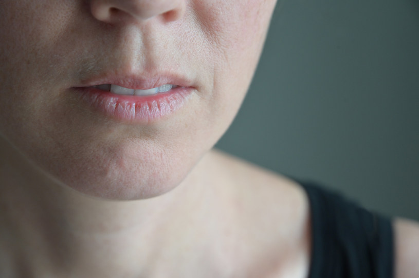 Twoje usta są suche i popękane? Sprawdź, co może być przyczyną /123RF/PICSEL