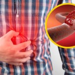 Tykająca bomba. Uważaj na tętniaka aorty