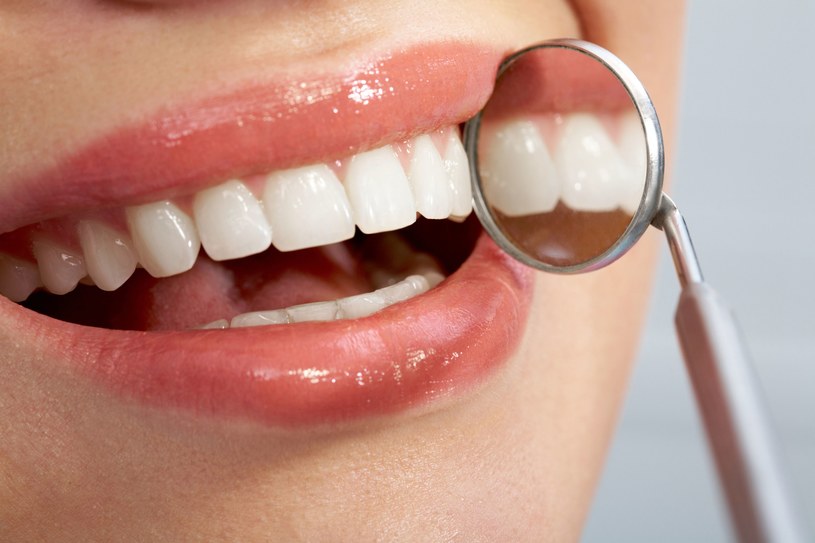 Tylko odpowiednia higiena i regularne wizyty u dentysty zapewnią ci piękne zęby /123/RF PICSEL