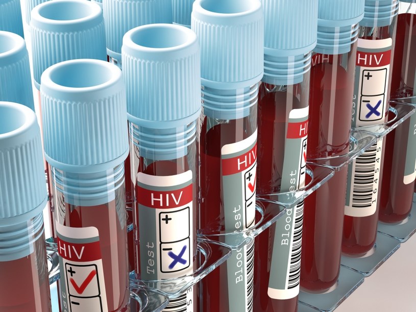 U elitarnych kontrolerów wirus HIV pozostaje na niewykrywalnym poziomie /123RF/PICSEL