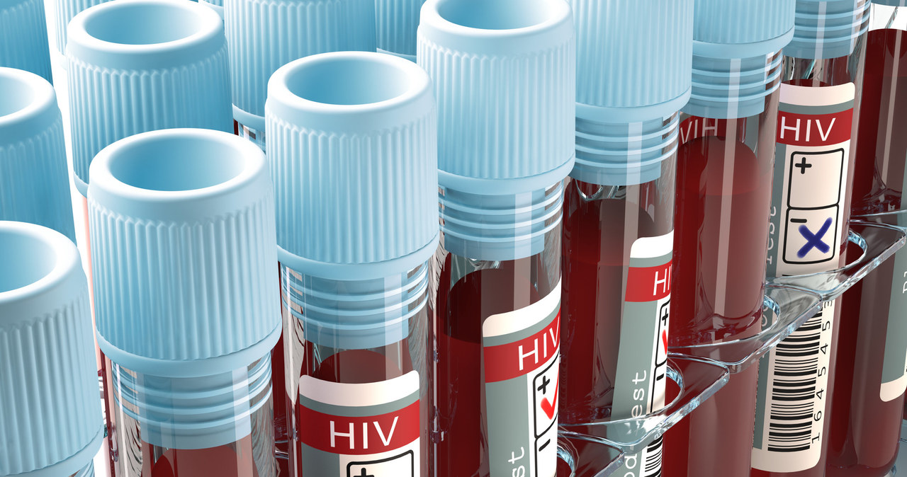 U elitarnych kontrolerów wirus HIV pozostaje na niewykrywalnym poziomie /123RF/PICSEL
