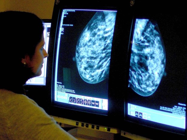 U kobiet najczęściej występującym nowotworem od wielu lat jest rak piersi /Rui Vieira    /PAP/EPA