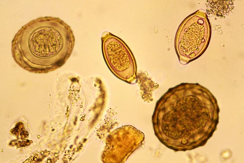 U osoby zarażonej tasiemcem w kale widoczne są segmenty ciała pasożyta , w których widoczne są jaja pasożyta /123RF/PICSEL