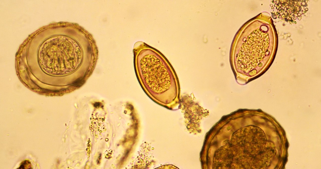 U osoby zarażonej tasiemcem w kale widoczne są segmenty ciała pasożyta , w których widoczne są jaja pasożyta /123RF/PICSEL