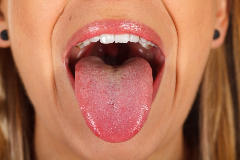 Uczucie krwi na języku świadczyć może m.in. o stanie zapalnym śluzówek nosa i zatok /123RF/PICSEL