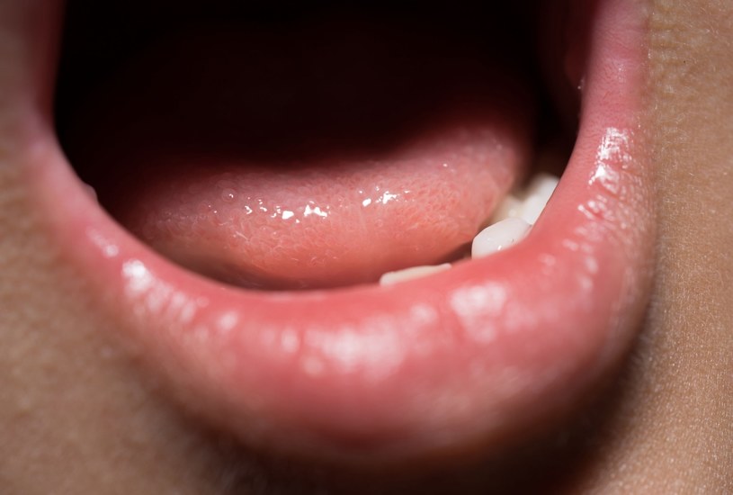 Uczucie suchości w ustach może być jednym z pierwszym objawów cukrzycy /123RF/PICSEL