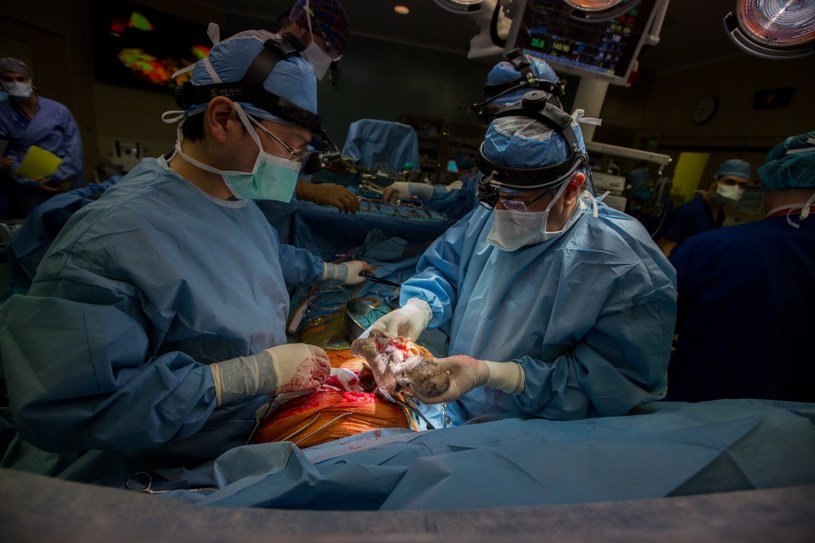 Udany przeszczep płuc u 61-latka po COVID-19 (Fot. Randy Risling/Toronto Star via Getty Images) /Getty Images