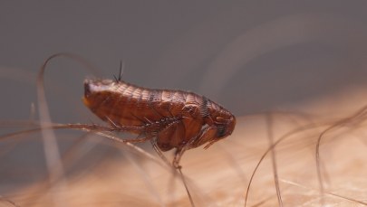 Ugryzła go pchła. Lekarze amputowali mu ręce i palce u stóp