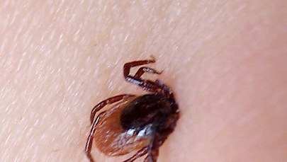 Ukąsił Cię kleszcz? Sprawdź, czy musisz iść do lekarza