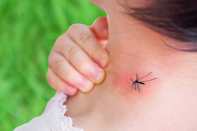 Ukąszenia komara może powodować swędzenie, a nawet obrzęk /123RF/PICSEL
