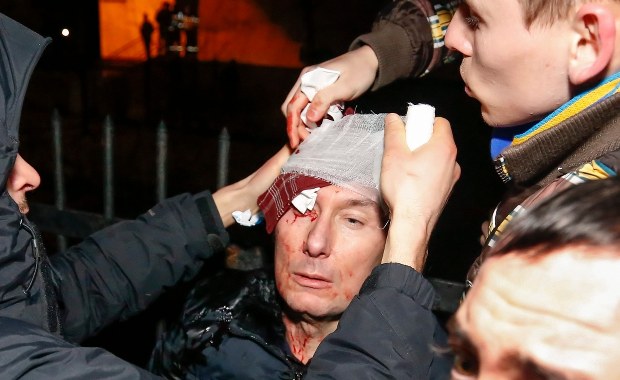 Ukraina: Stan pobitego opozycjonisty poważny. Ma wstrząśnienie mózgu