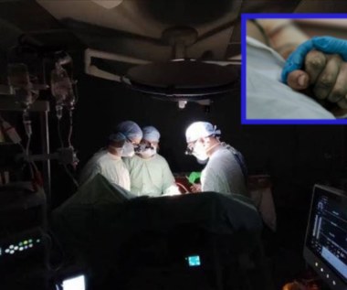 Ukraińscy lekarze dokonali udanej operacji serca, pomimo braku prądu