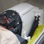 Ultradźwiękowy kask zamiast operacji. Przełom w leczeniu chorób mózgu